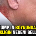 Trump’ın boynundaki kızarıklığın nedeni belli oldu