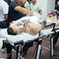 Şanlıurfa’da hastane bahçesinde silahlı saldırı: 1’i çocuk 2 yaralı