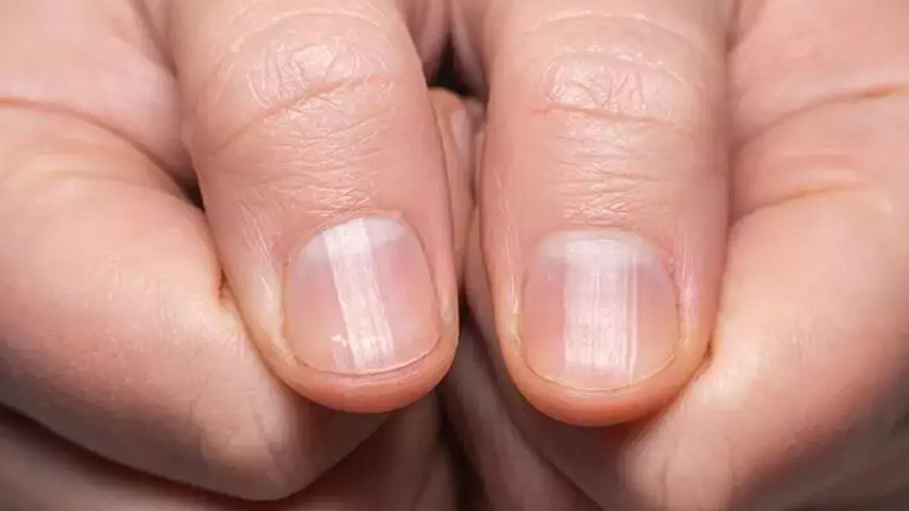 Tırnaklardaki sessiz değişim akciğer sağlığını tehdit mi ediyor?