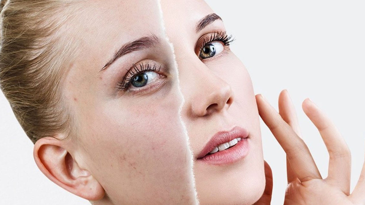 Bisturi yok, filtre yok: Daha genç görünmenin 5 altın adımı