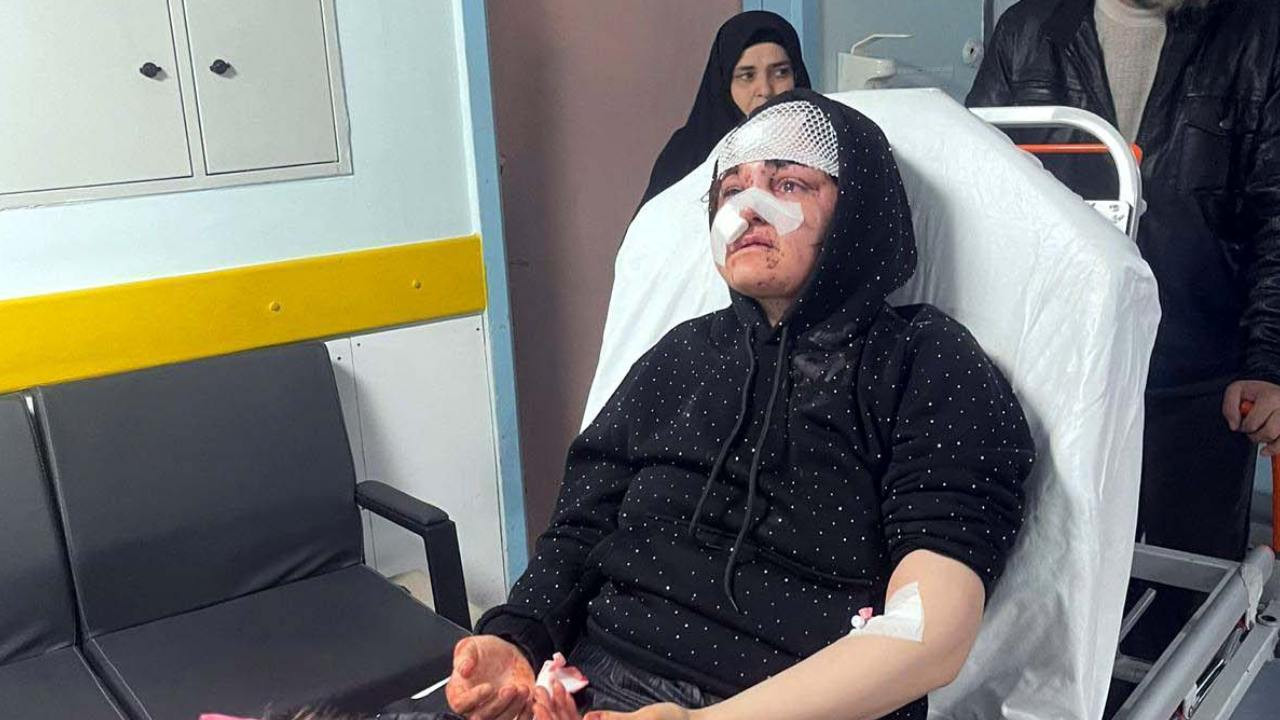 Boşanma aşamasındaki kadına sokak ortasında vahşet: Kaldırım taşıyla darp edildi