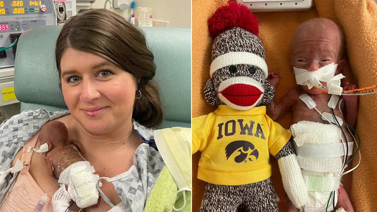 5 aylık doğdu, Guinness’e girdi: Dünyanın en prematüre bebeği rekoru kırıldı