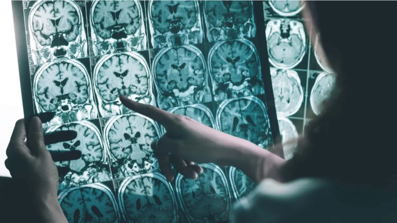 Beyni koruyan miras... Modern diyetin panzehiri oldu