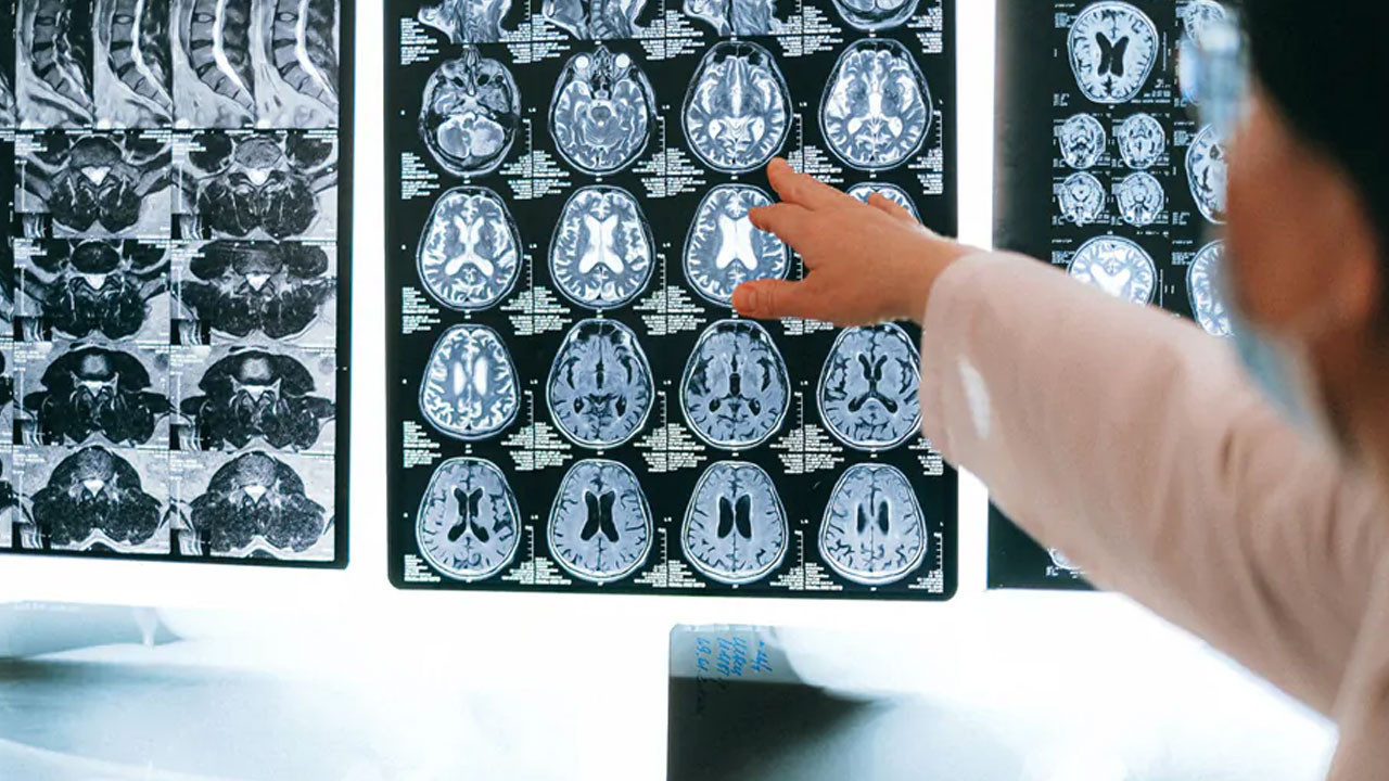 Beyin gelişimini rehin alan besinler... Kaşıkla gelen tehlike