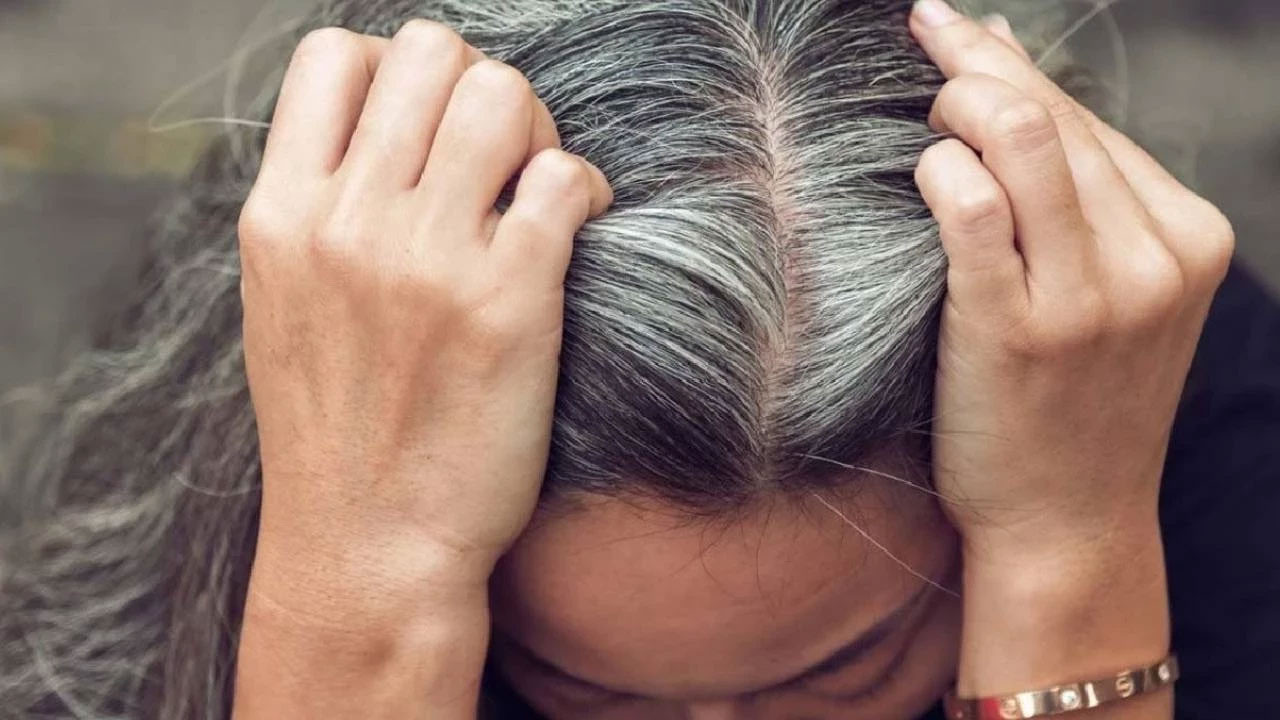 Erken yaşta saç beyazlamasındaki 'kimsenin bilmediği detay' ne? Uzmanlar anlattı