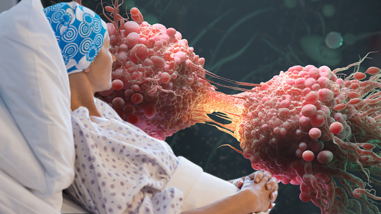 Kanser vakaları artıyor: Dünyada 20 milyon Türkiye’de 240 bin yeni tanı