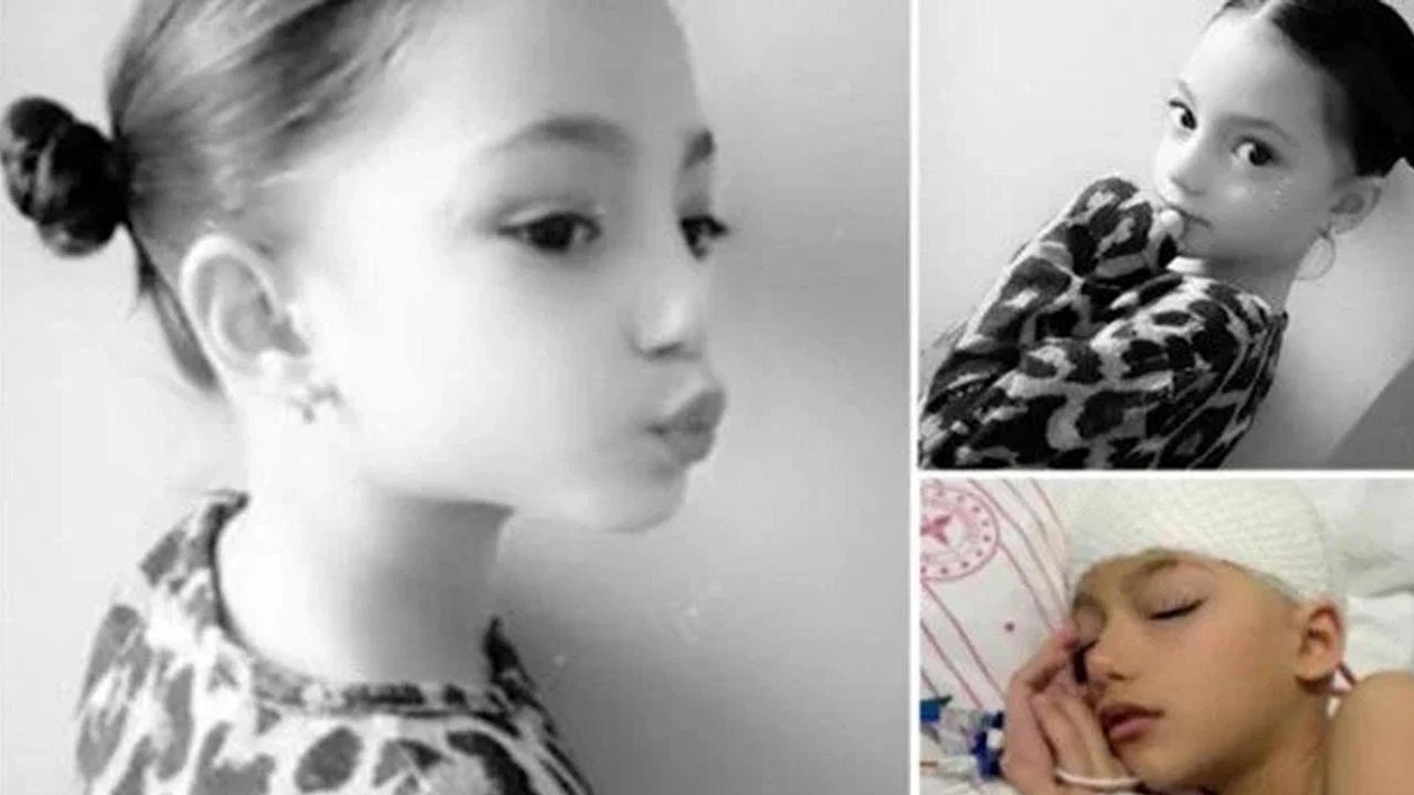 Beyin kanaması geçiren çocuklarda ameliyatsız tedavi mümkün mü?