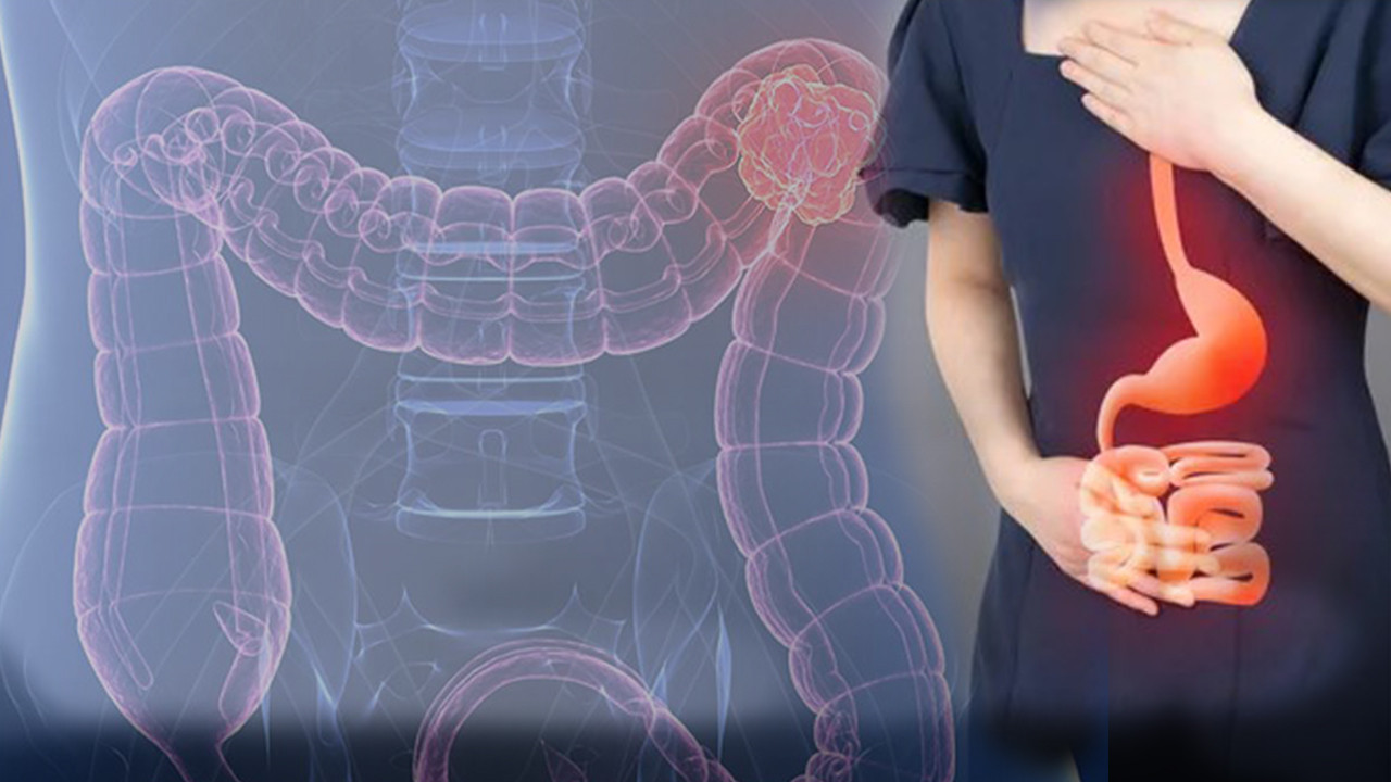 Bağırsaklardaki gizli kahraman: CAG-170 Keşfi