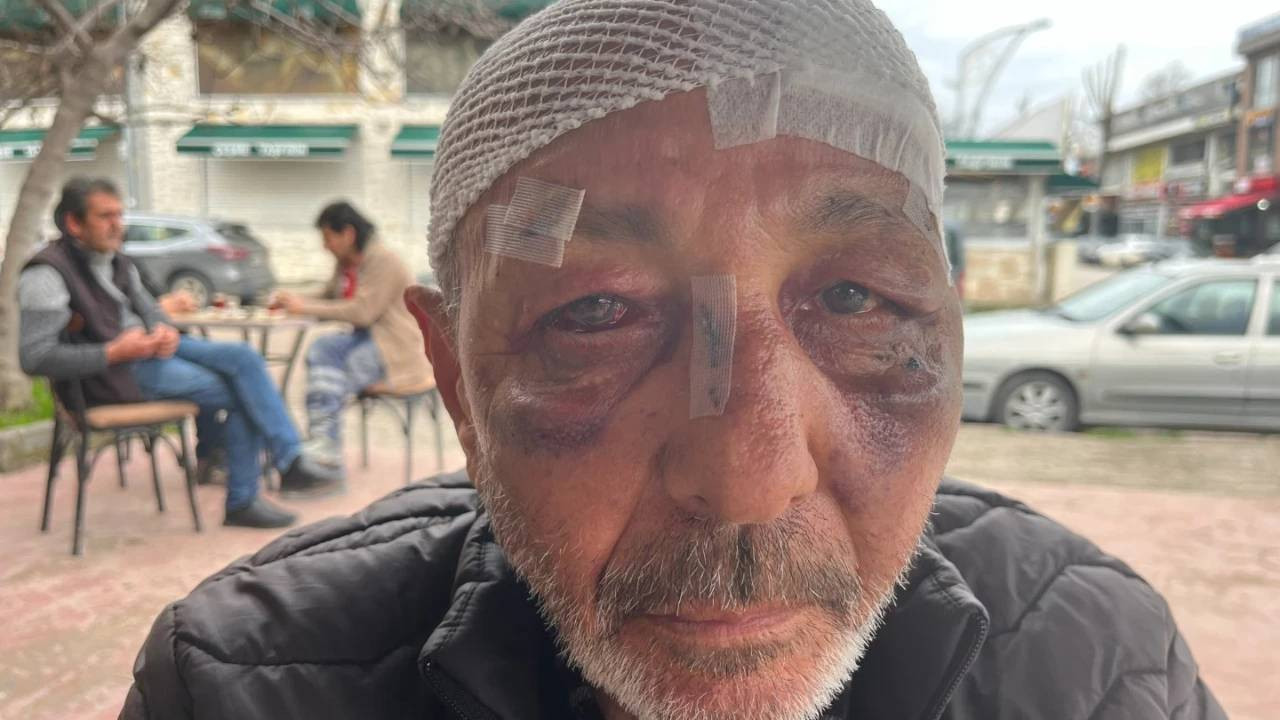 Çakmağını verdi, saldırıya uğradı: Kocaeli’de 67 yaşındaki adam sokak ortasında darbedildi