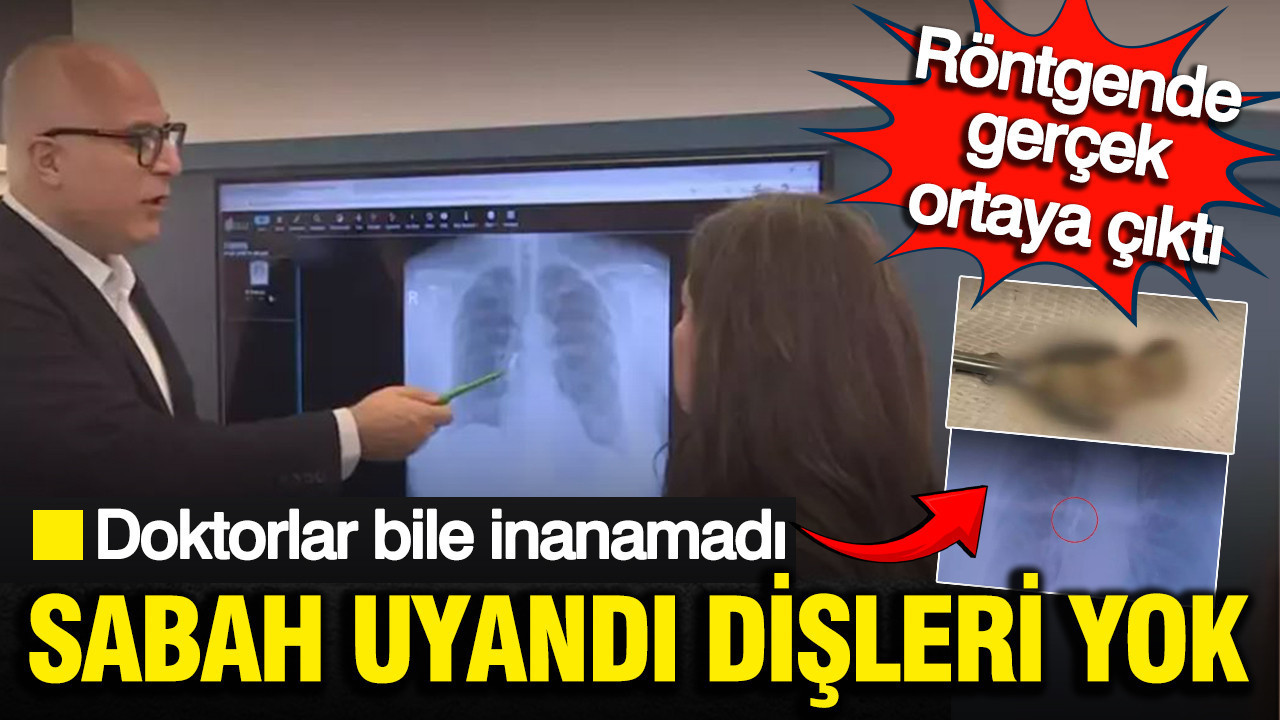Sabah kalktığında dişleri yoktu: Röntgende gerçek ortaya çıktı, doktorlar bile inanamadı