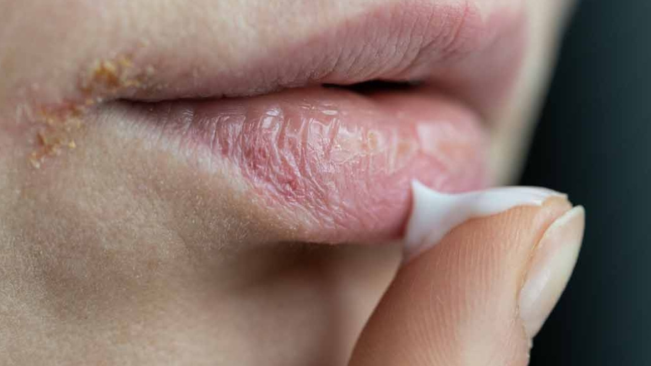 Susuzluk değil, uyarı: Ağız kuruluğu hafife alınmamalı