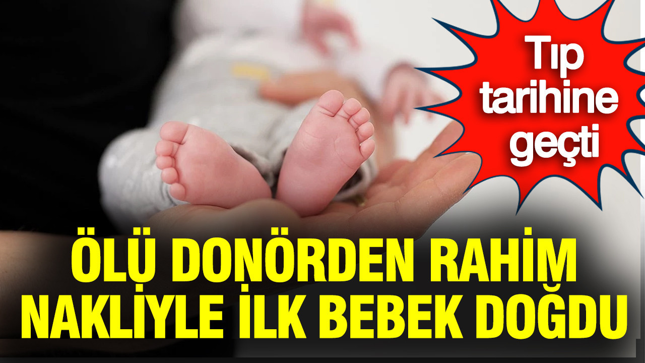 Tıp tarihine geçti: Ölü donörden doğdu
