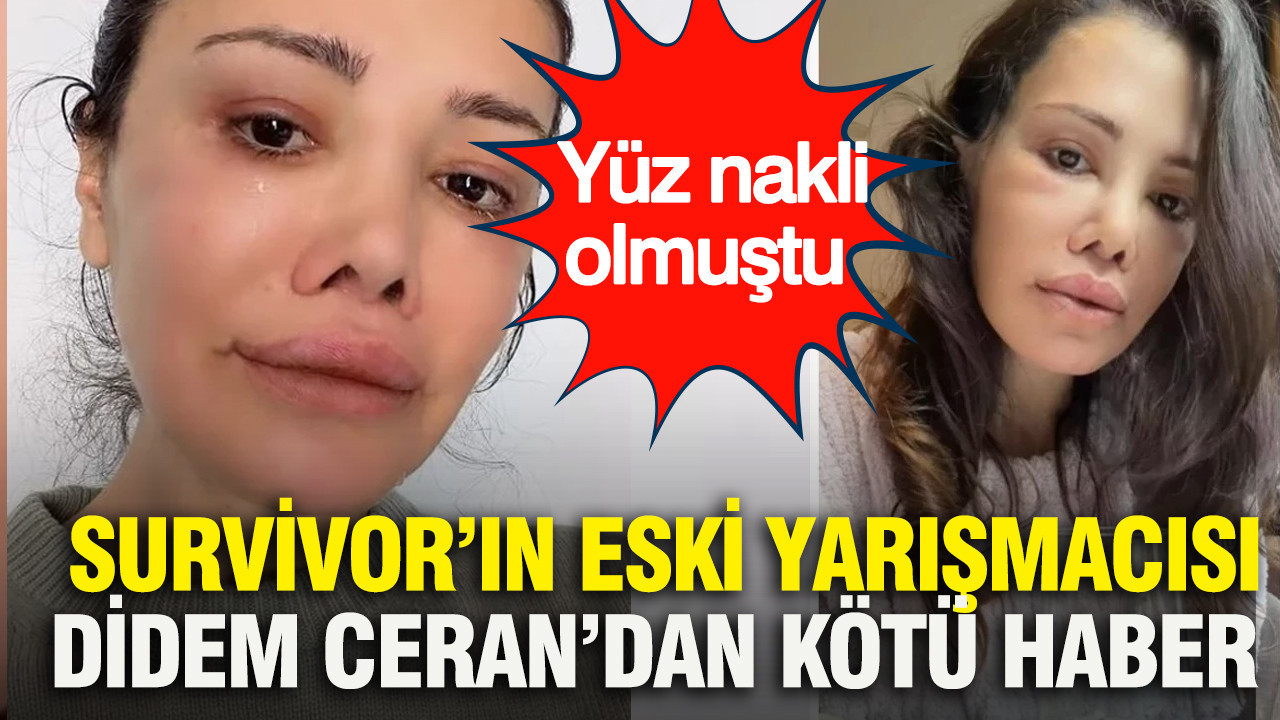 Survivor’ın eski yarışmacısı Didem Ceran’dan yürek burkan haber: Yüz nakli olmuştu