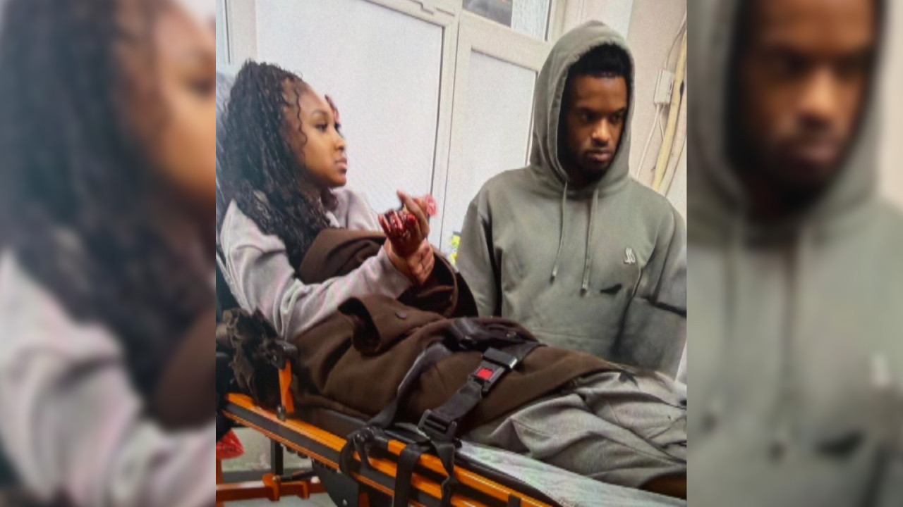 Fenerbahçeli futbolcu Semedo dün sakatlanmıştı: Eşi bugün trafik kazası geçirdi