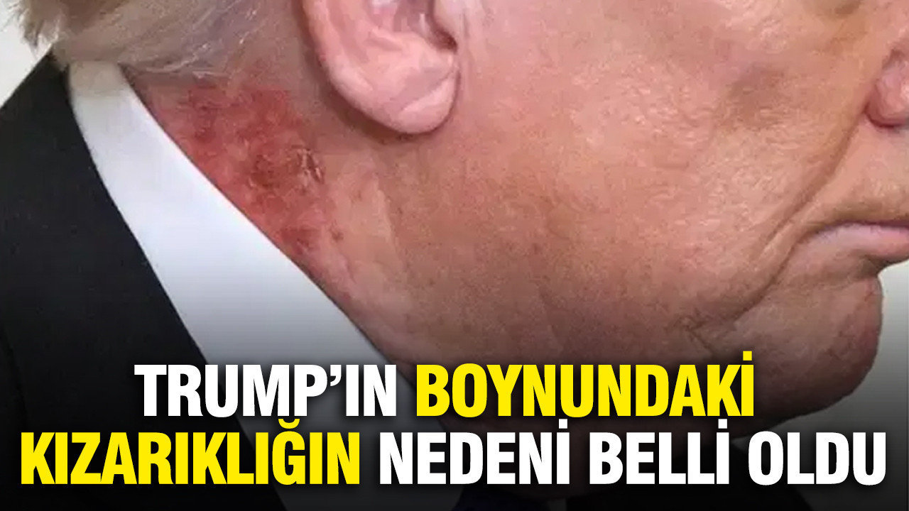 Trump’ın boynundaki kızarıklığın nedeni belli oldu