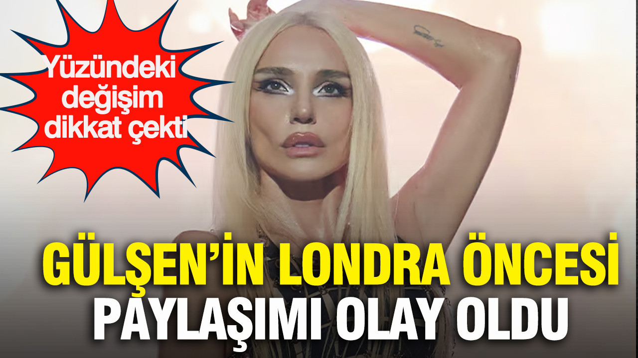 Gülşen’in Londra öncesi paylaşımı olay oldu: Yüzündeki değişim dikkat çekti