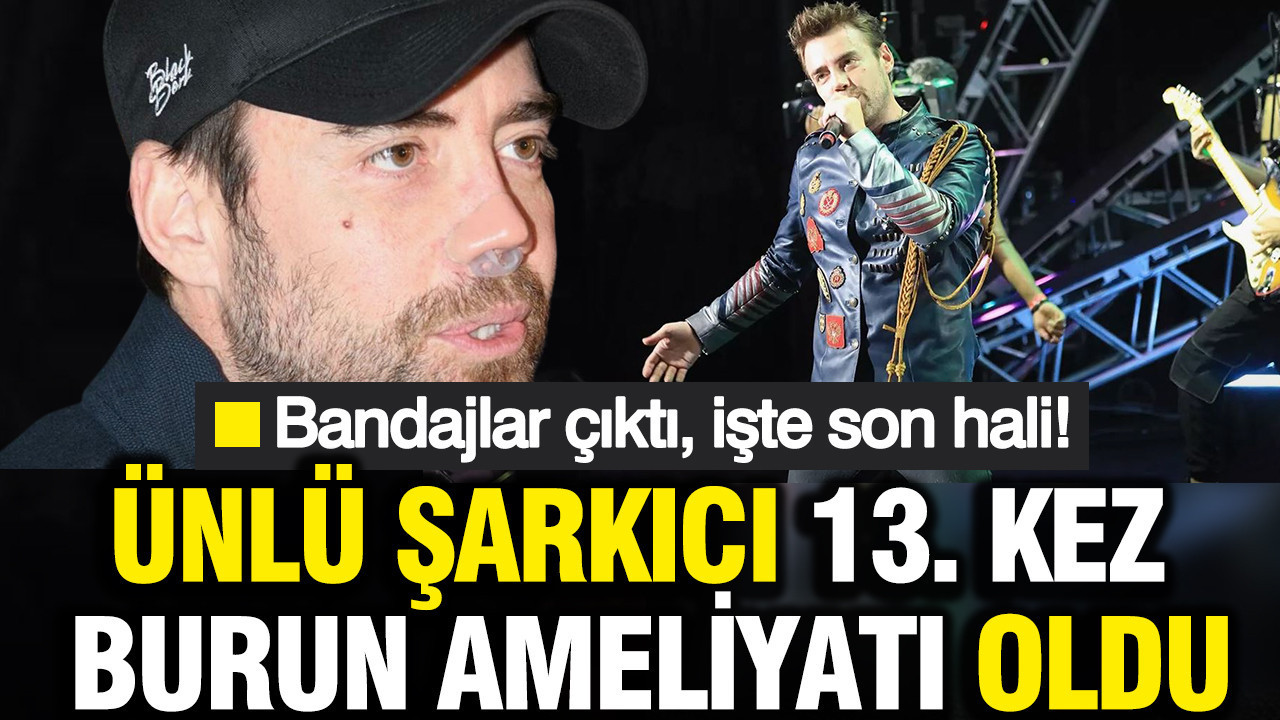 Murat Dalkılıç 13. kez burun ameliyatı oldu: Bandajlar çıktı, İşte son hali