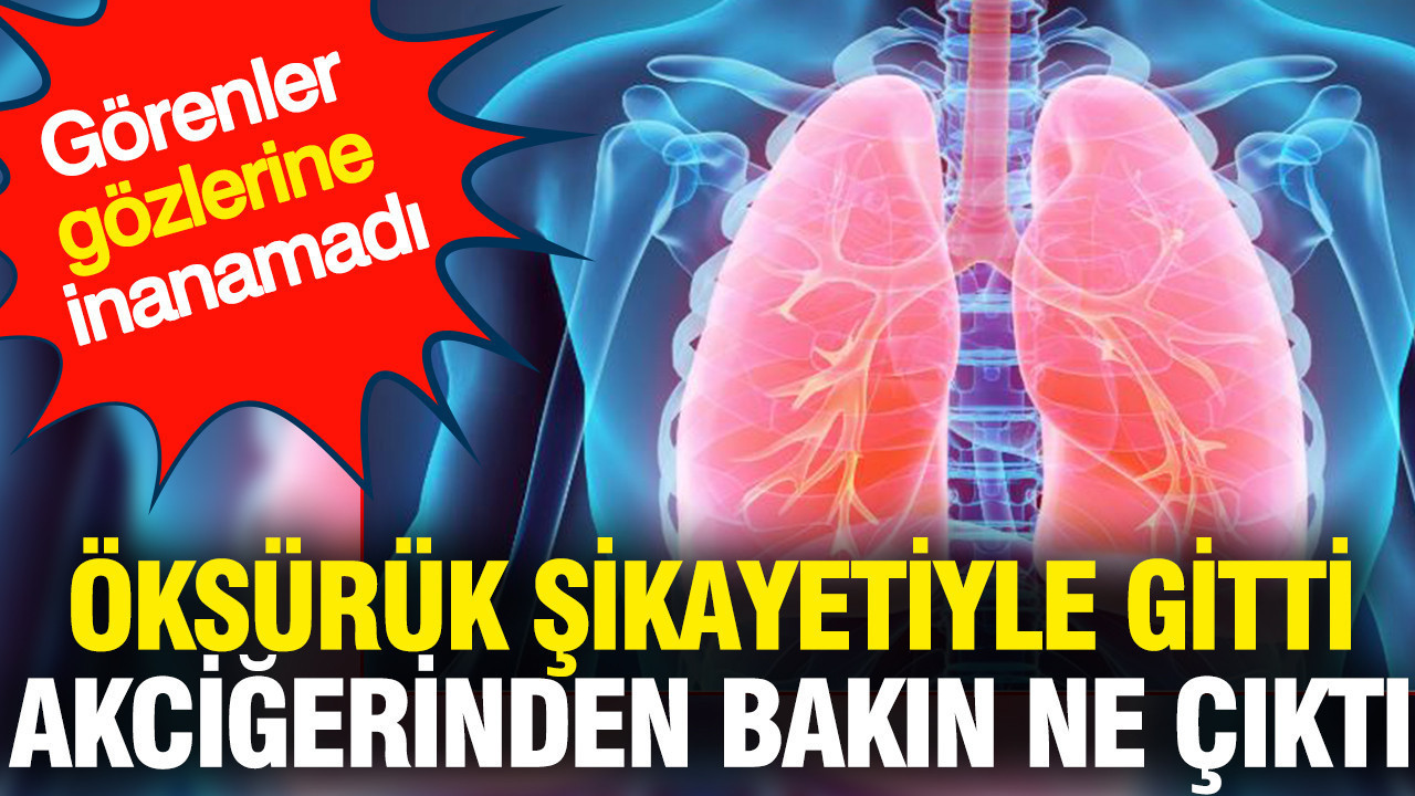 Öksürük şikayetiyle gitti akciğerinden bakın ne çıktı: Görenler gözlerine inanamadı