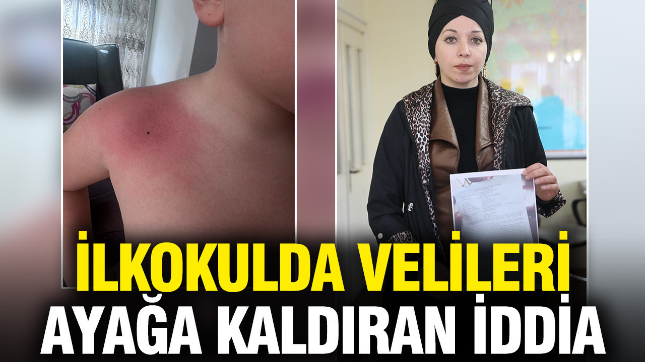İlkokulda darp iddiası: Aile öğretmenden şikayetçi oldu