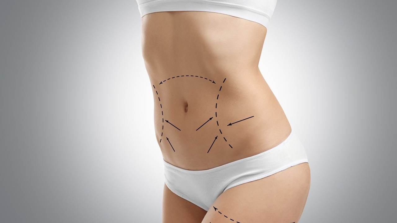 Karın germe ameliyatı nedir? Abdominoplasti hakkında merak ettikleriniz