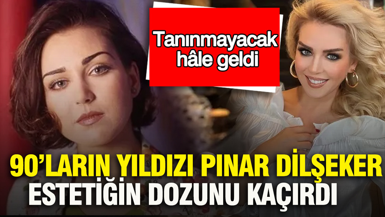 90’ların yıldızı Pınar Dilşeker estetiğin dozunu kaçırdı: Tanınmayacak hâle geldi