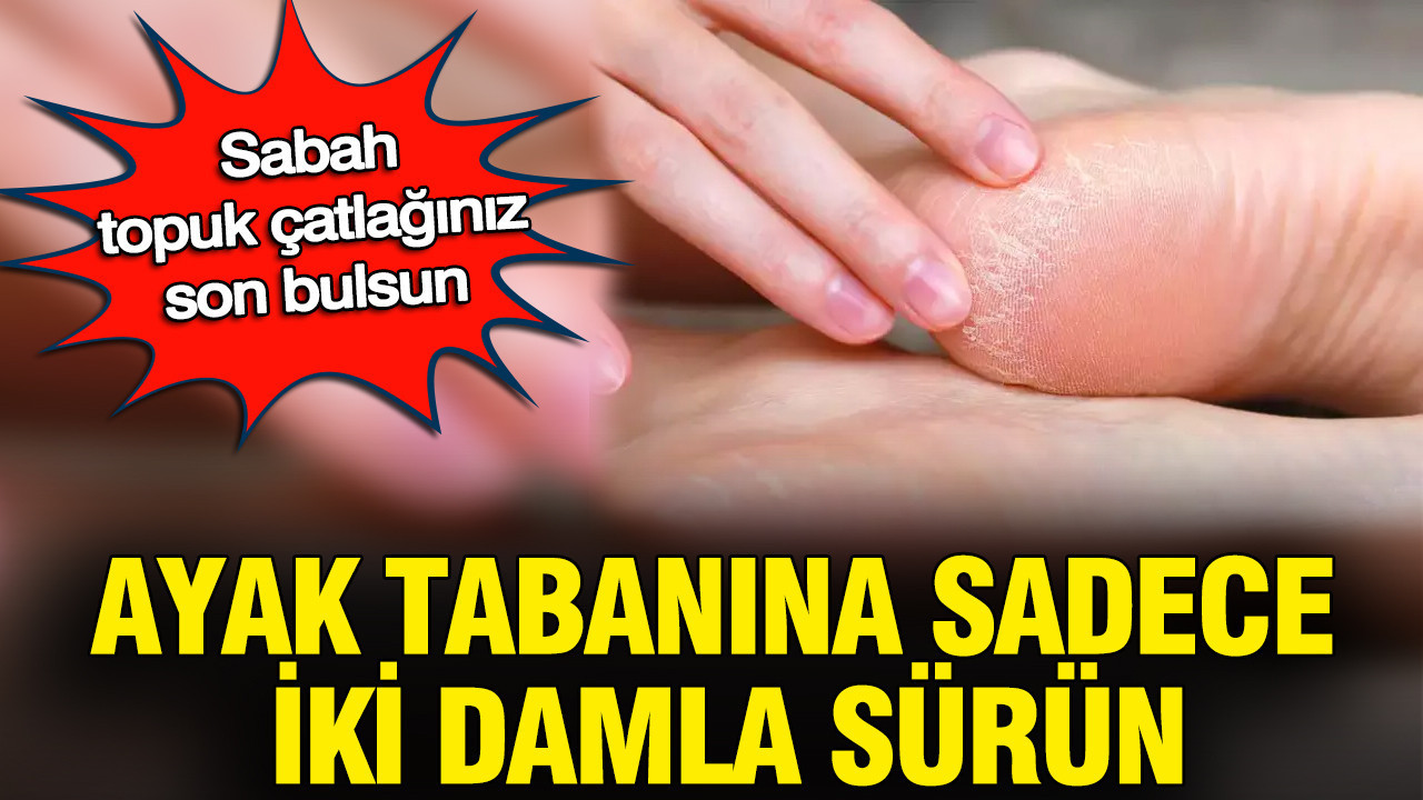 Yatmadan önce topuklarınıza bu karışımı dürün: Çatlaklar bir gecede kayboluyor