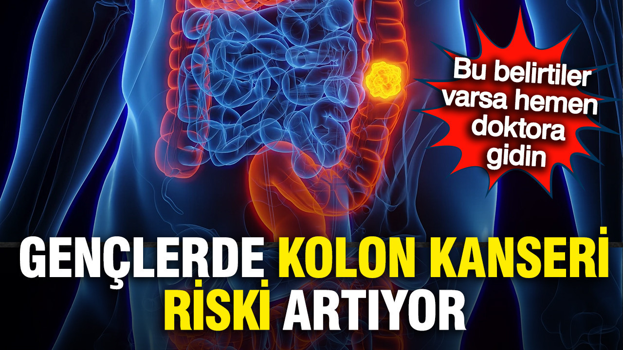 Uzmanlardan kritik uyarı: Kolon kanseri gençlerde hızla artıyor