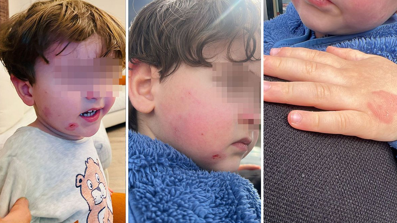 Çocuğunu kreşe bırakan anneye büyük şok: Evladını almaya geldiğinde darp edilmiş halde buldu