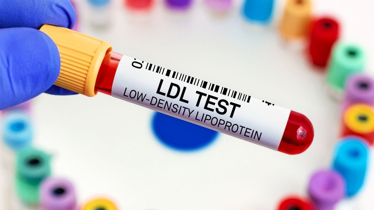 Kolesterolde 'İyi-kötü' devri kapandı: Yeni nesil kılavuz açıklandı