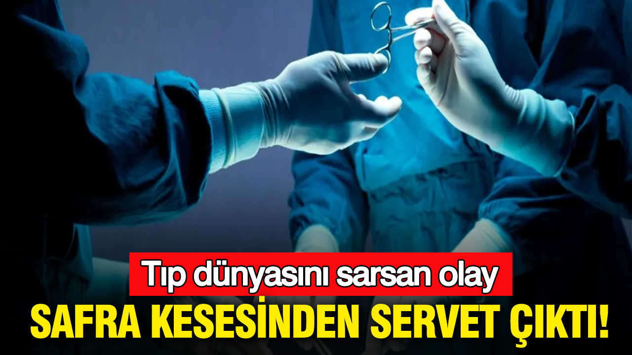 Bingöl’de tıp dünyasını sarsan olay: Safra kesesinden servet çıktı