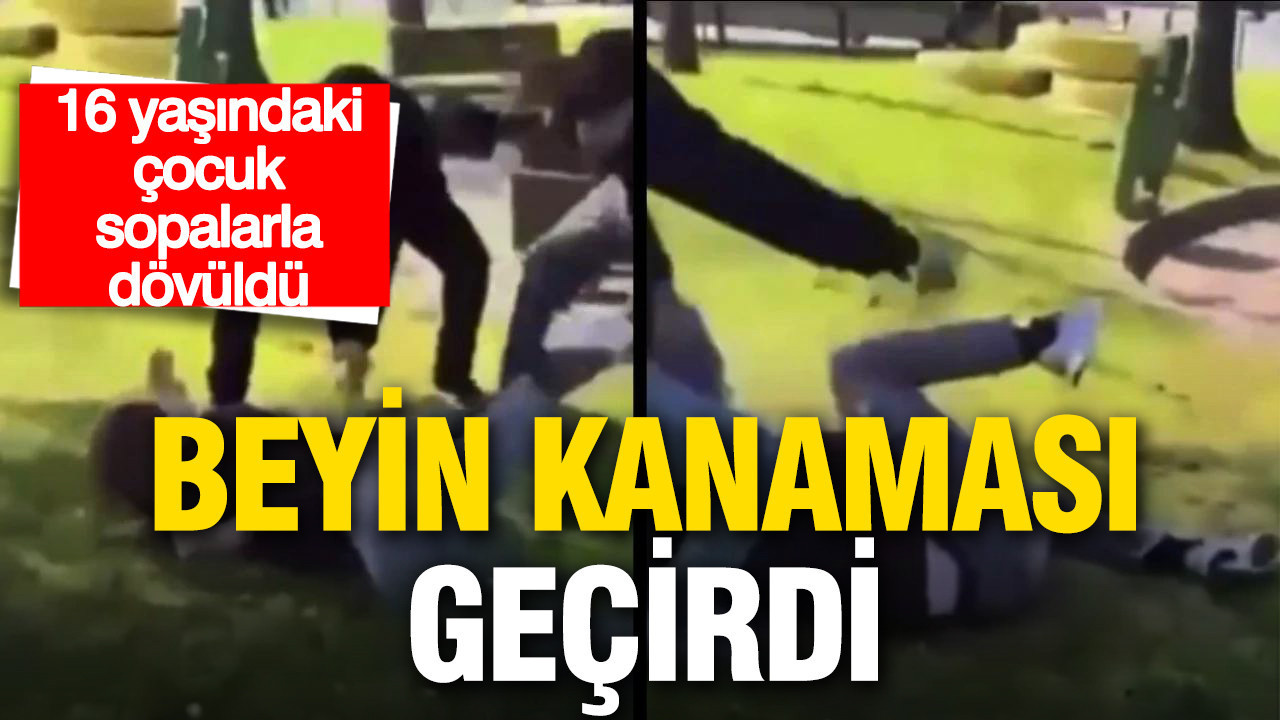 Parkta dehşet: 16 yaşındaki çocuk sopalarla dövüldü, beyin kanaması geçirdi