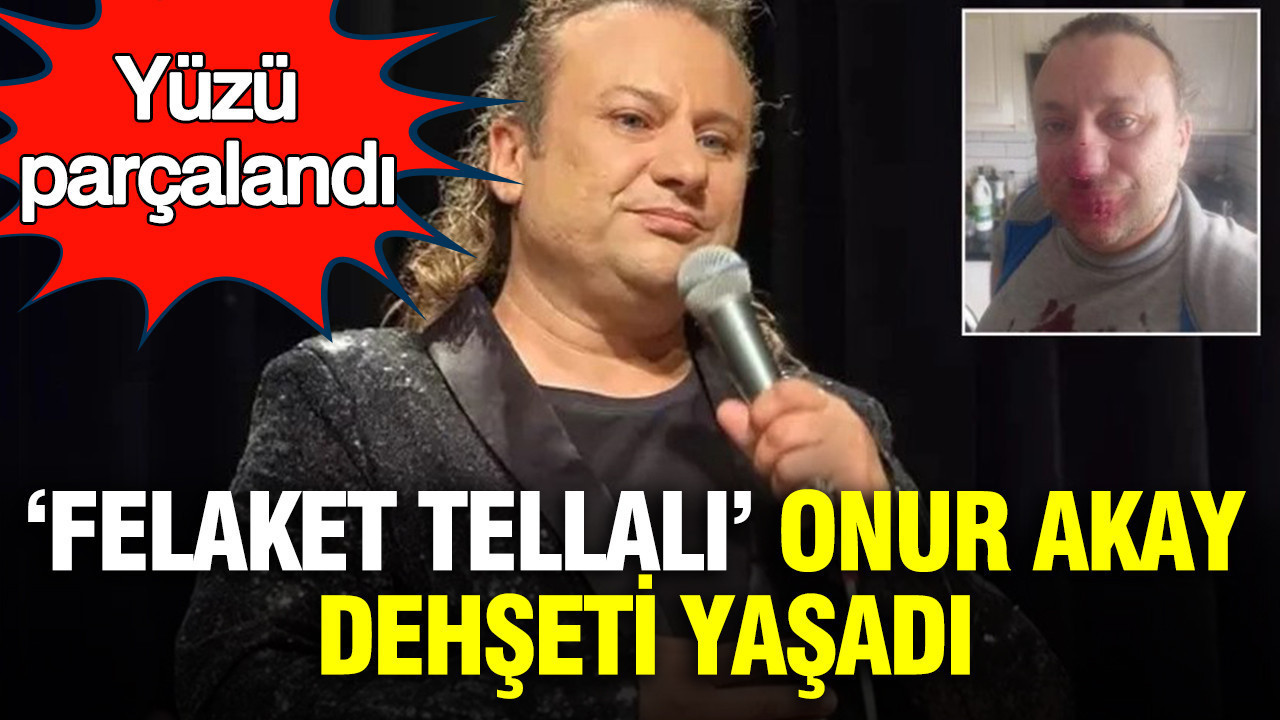 "Felaket tellalı" Onur Akay dehşeti yaşadı: Sahipsiz pitbull saldırısında yüzü parçalandı