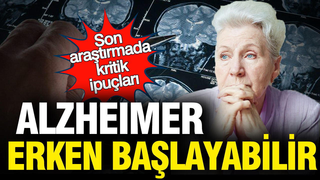 Araştırma: Alzheimer düşünüldüğünden daha erken başlayabilir