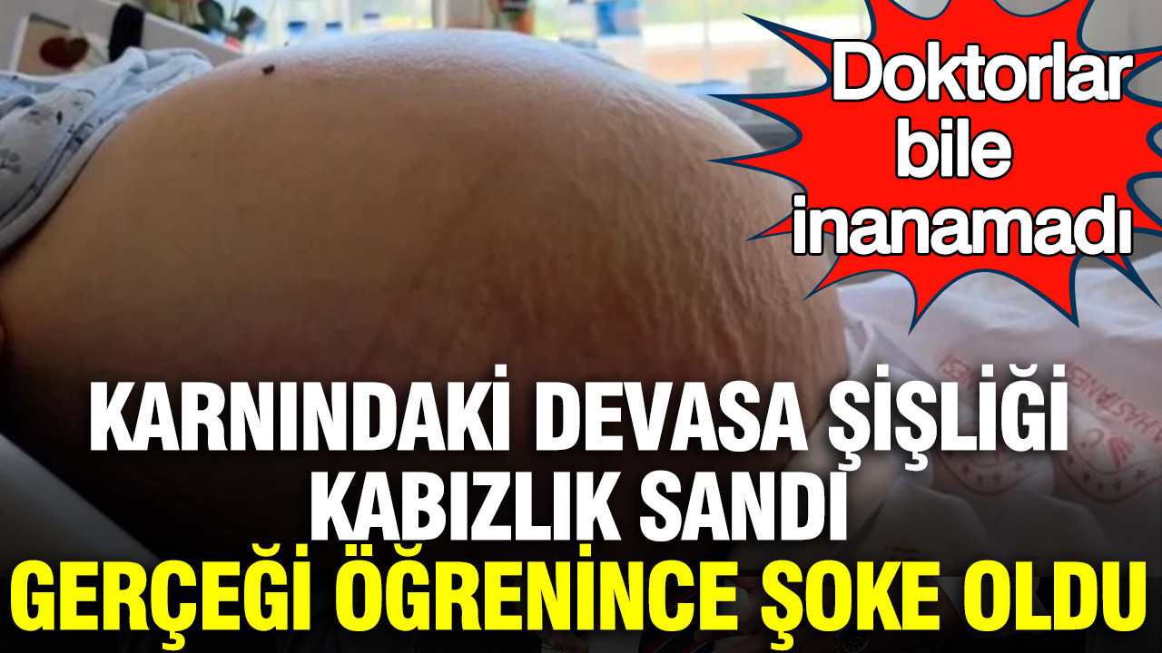 Karnındaki devasa şişliği kabızlık sandı, gerçeği öğrenince şoke oldu: Doktorlar bile inanamadı