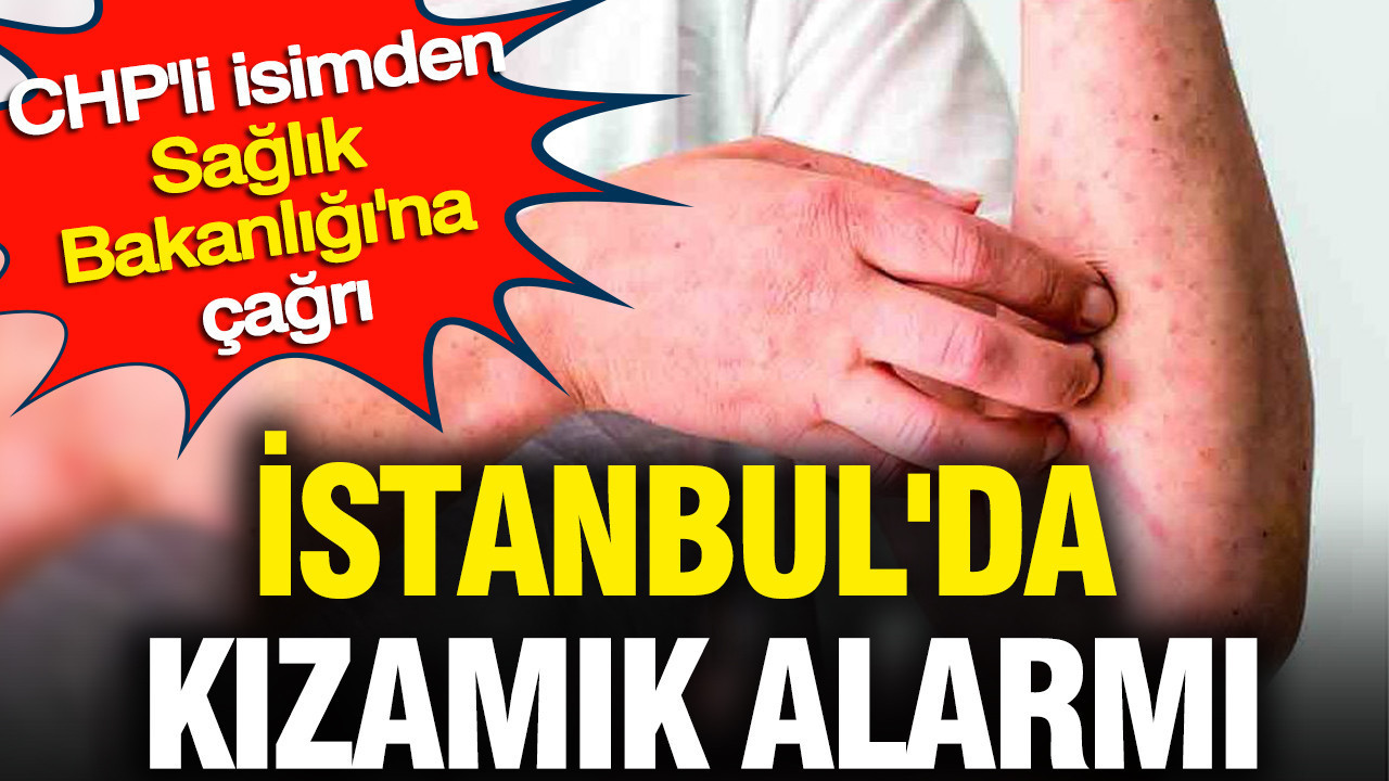 İstanbul'da kızamık alarmı: CHP'li isimden Sağlık Bakanlığı'na çağrı