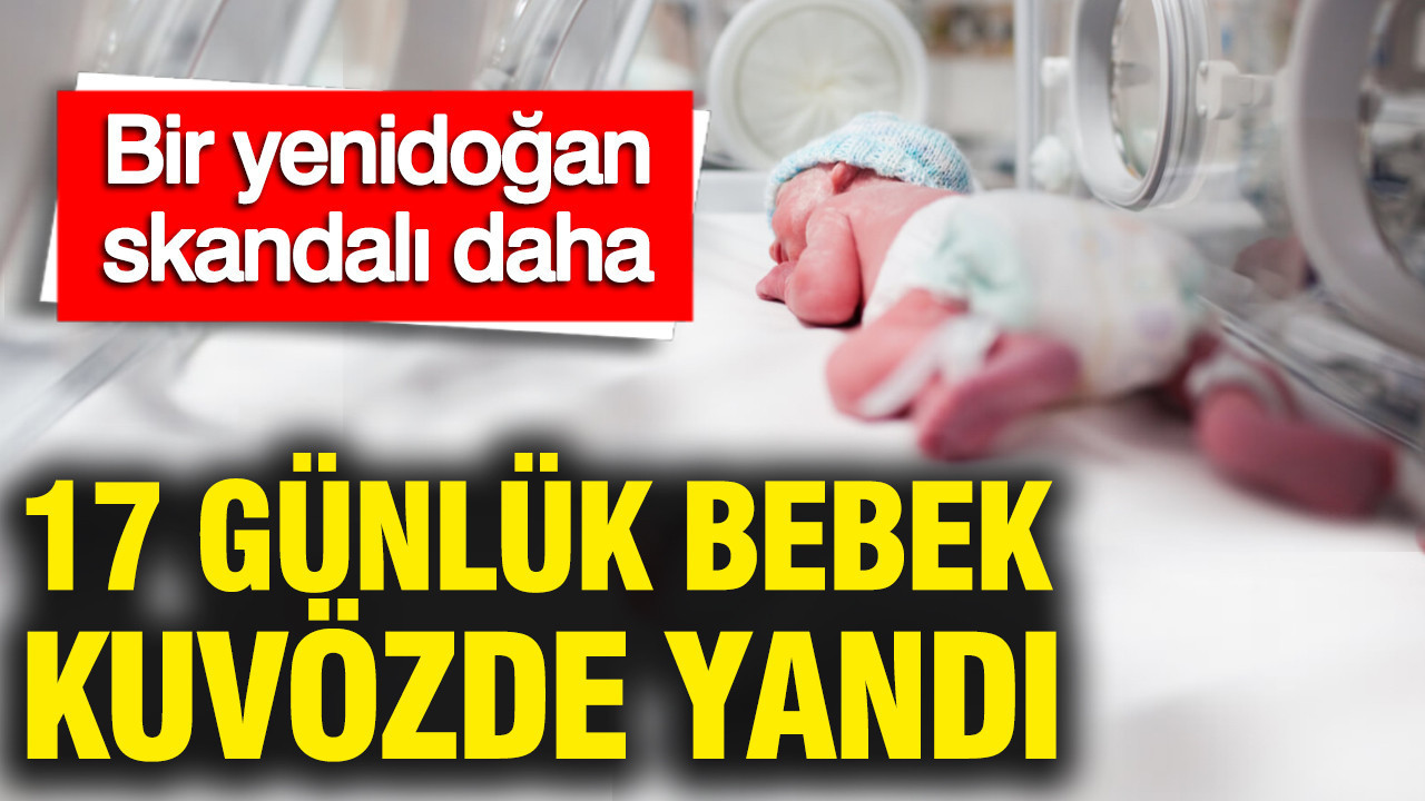 Bir yenidoğan skandalı daha: 17 günlük bebek kuvözde yandı