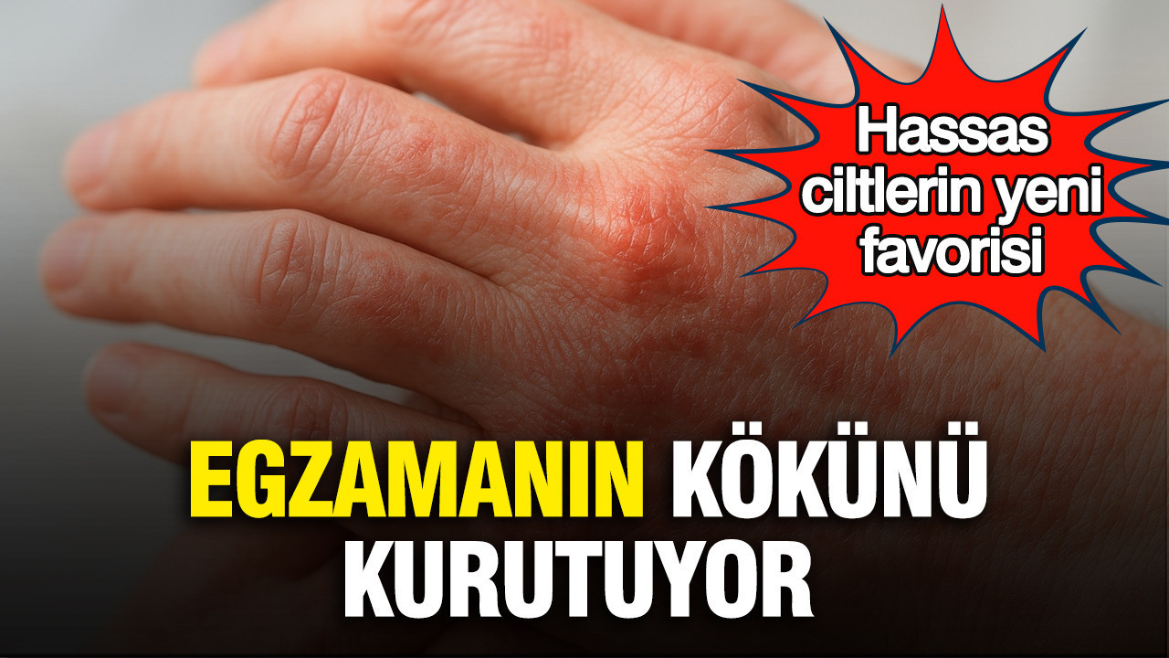 Hassas ciltlerin yeni favorisi: Egzamanın kökünü kurutuyor