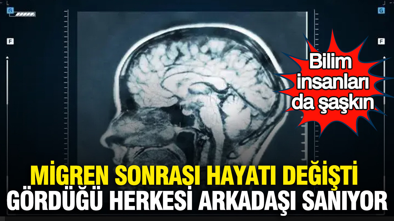 Migren sonrası hayatı değişti: Gördüğü herkesi arkadaşı sanıyor… Bilim insanları da şaşkın