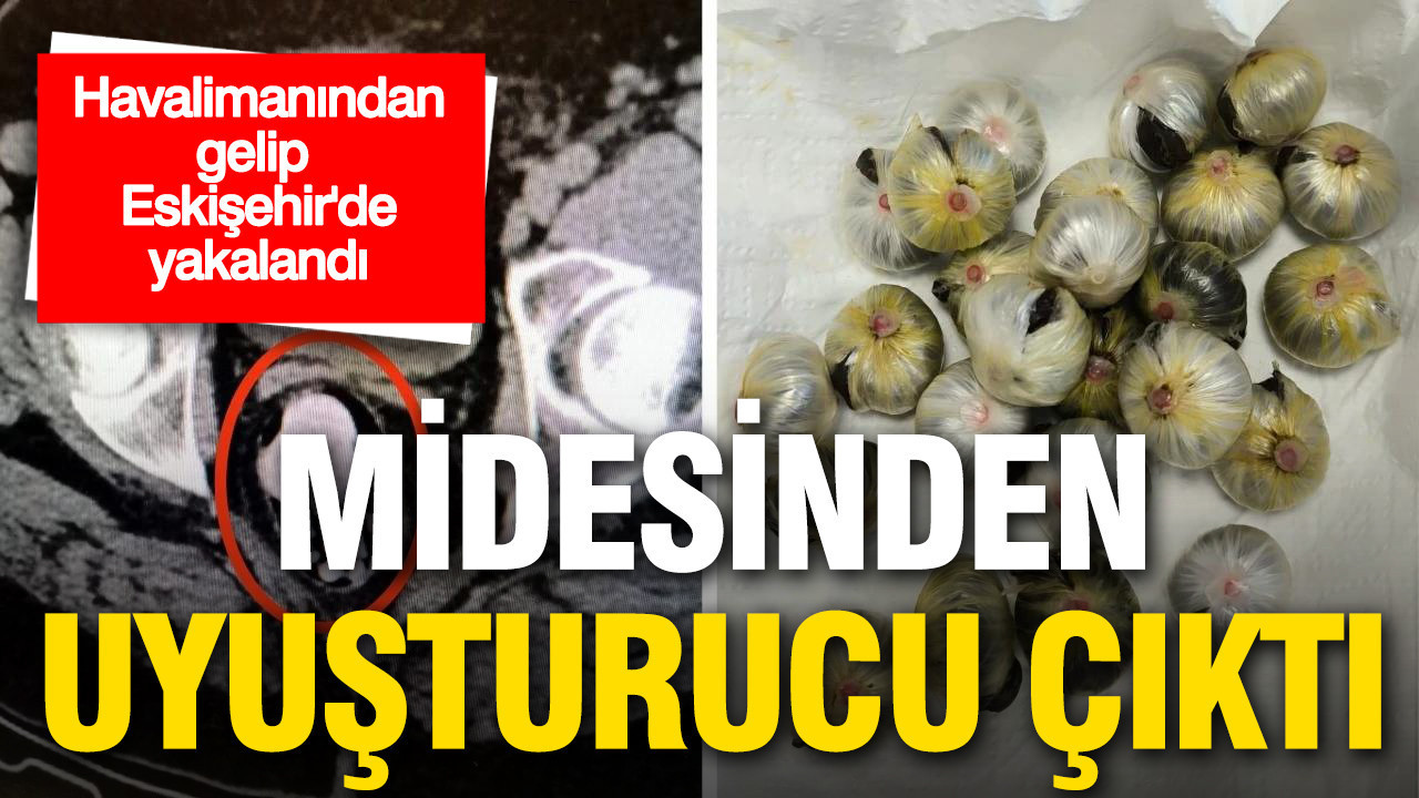 Midesinden uyuşturucu çıktı: Havalimanından gelip Eskişehir’de yakalandı