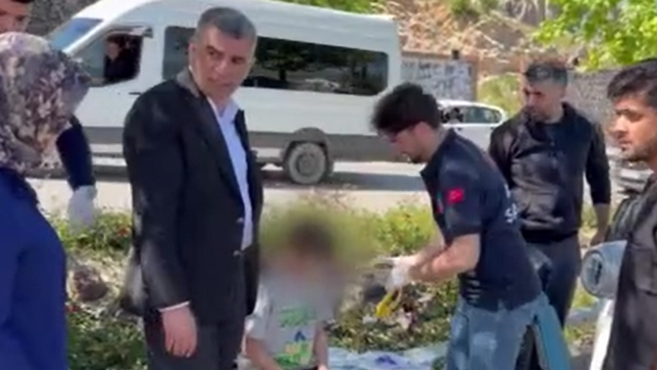 Yaralı çocuğun imdadına o milletvekili yetişti