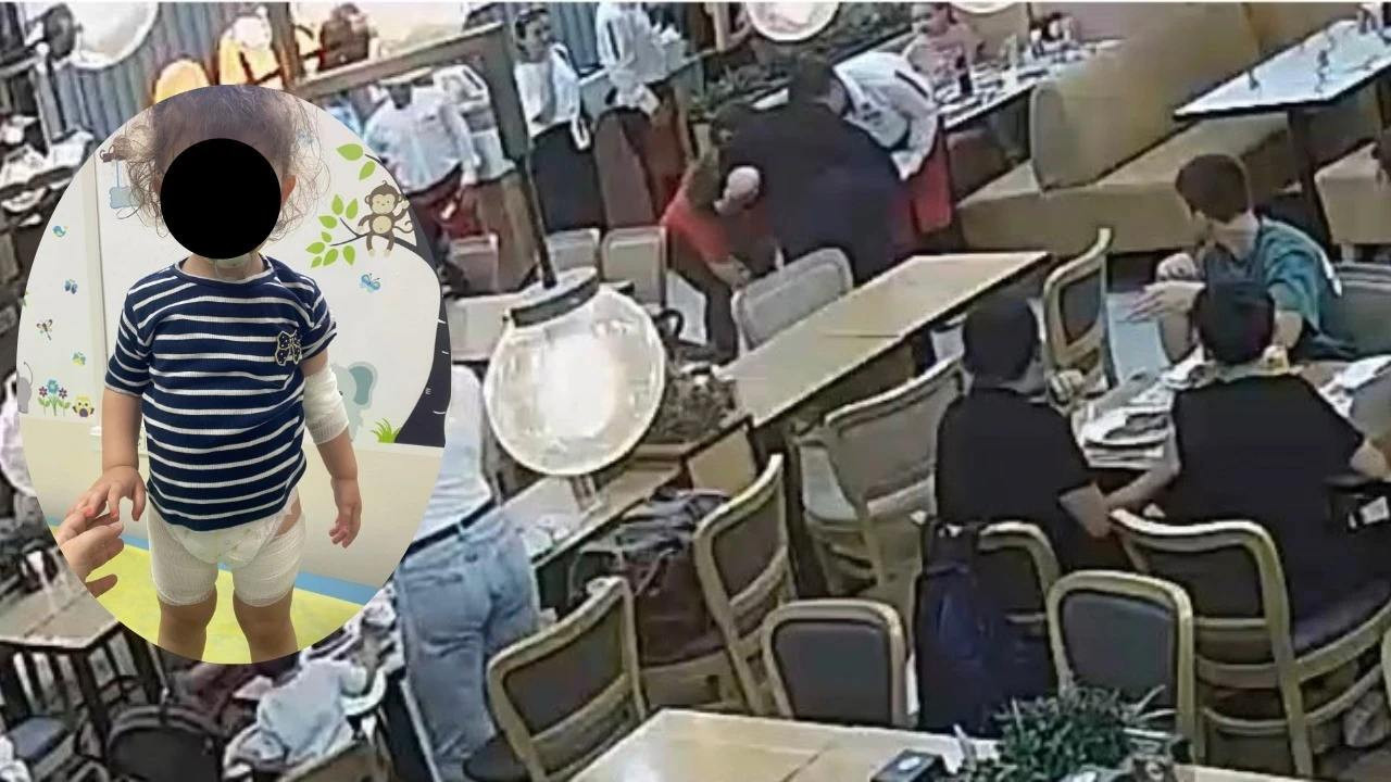 Tereyağı şovu faciaya dönüştü: 2 yaşındaki bebek yaralandı