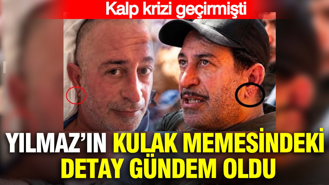 Cem Yılmaz’ın kulak memesindeki detay gündem oldu: Kalp krizi geçirmişti