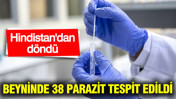 Hindistan’dan döndü, beyninde 38 parazit tespit edildi