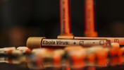 DSÖ’den Ebola alarmı: Risk seviyesi çok yüksek ilan edildi