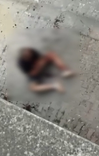 Başında şişe kırdılar, şikayetçi bile olmadı: Zeytinburnu'nda garip olay - Resim : 1