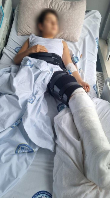 Tünelde feci kaza: 1 ölü, 1 yaralı var - Resim : 3