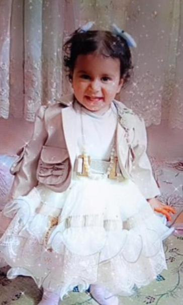 Ankara'da rekor tazminat, Konya'da yargı izni: Sokak k&ouml;peklerinin dehşeti: 2 yaşındaki Rana'yı par&ccedil;alamıştı - Resim : 5