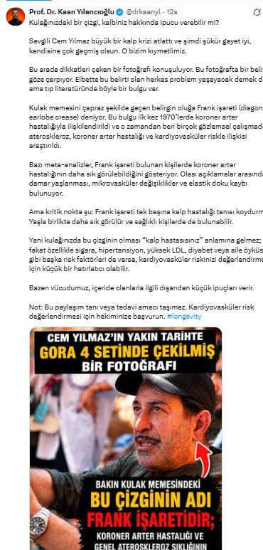 Cem Yılmaz’ın kulak memesindeki detay gündem oldu: Kalp krizi geçirmişti - Resim : 2