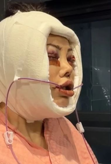 Survivor’ın eski yarışmacısı Didem Ceran’dan yürek burkan haber: Yüz nakli olmuştu - Resim: 6