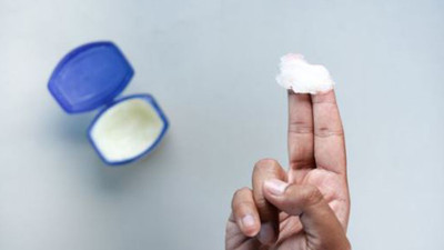 Vazelin zararlı mı? Ne işe yarar? Vazelin kullanımı güvenli mi?